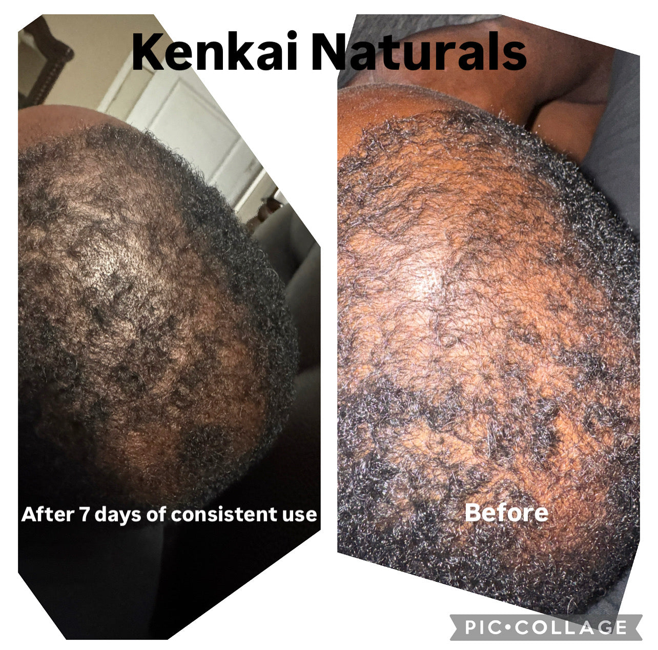 Kenkai Rose Radiance Growth Oil 4oz